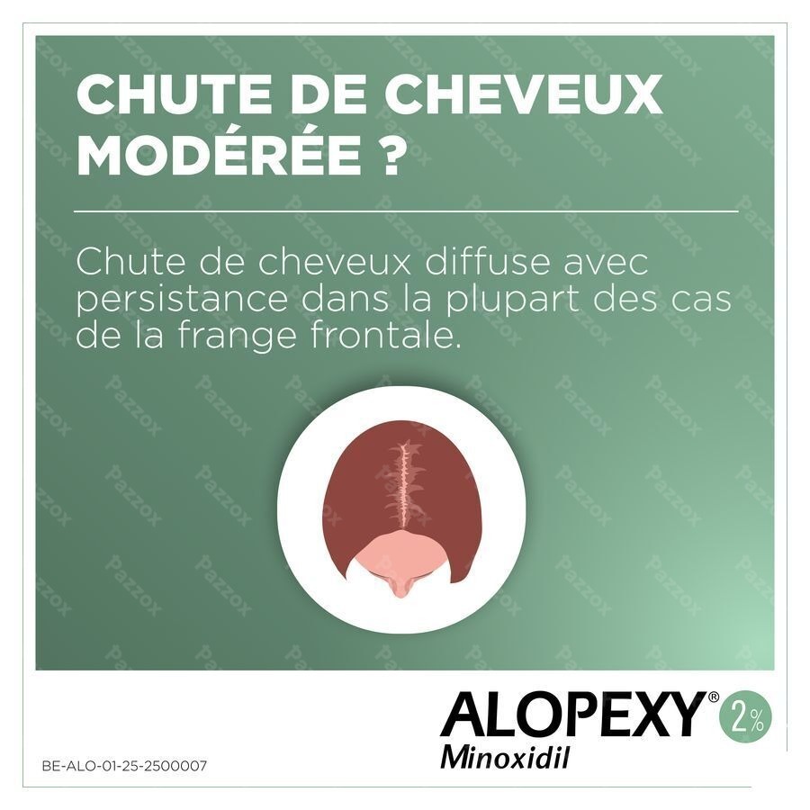 Alopexy 2% 3 x 60ml