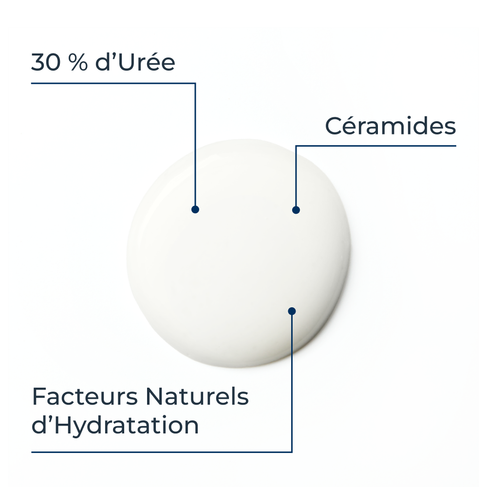 Eucerin UreaRepair Crème 30% d'Urée Application Locale Zones Cutanées Extrémement Sèches Tube 75ml