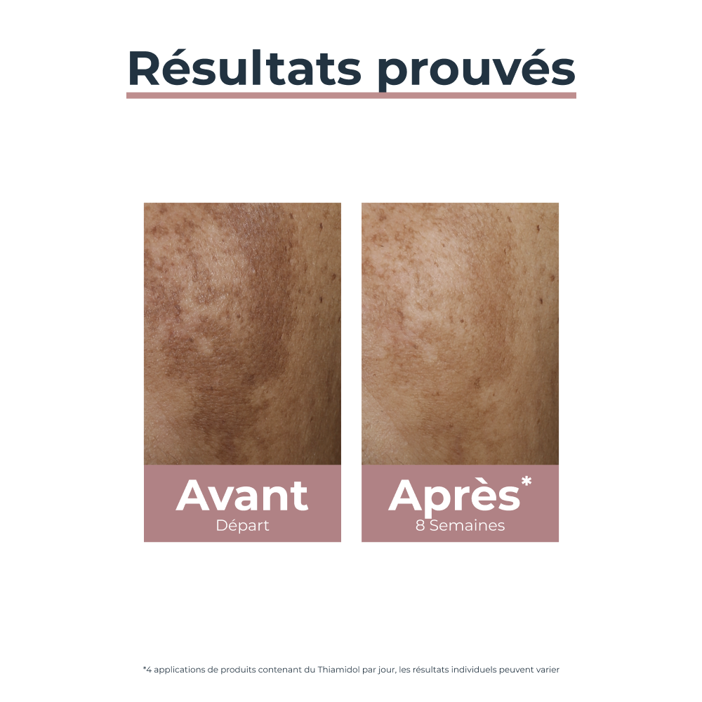 Eucerin Anti-Pigment Correcteur de Taches Application Locale Hyperpigmentation 5ml