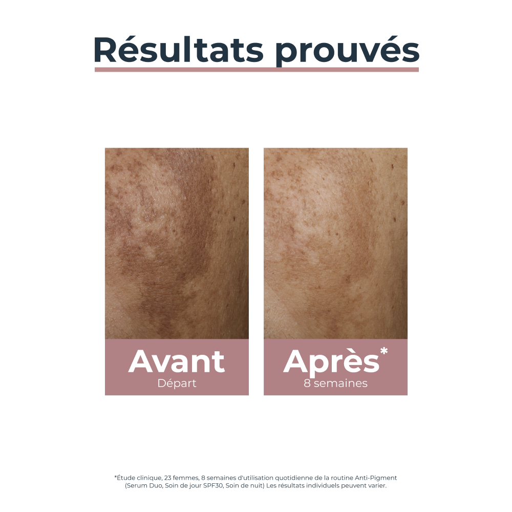 Eucerin Anti-Pigment Soin de Nuit Hyperpigmentation 50ml