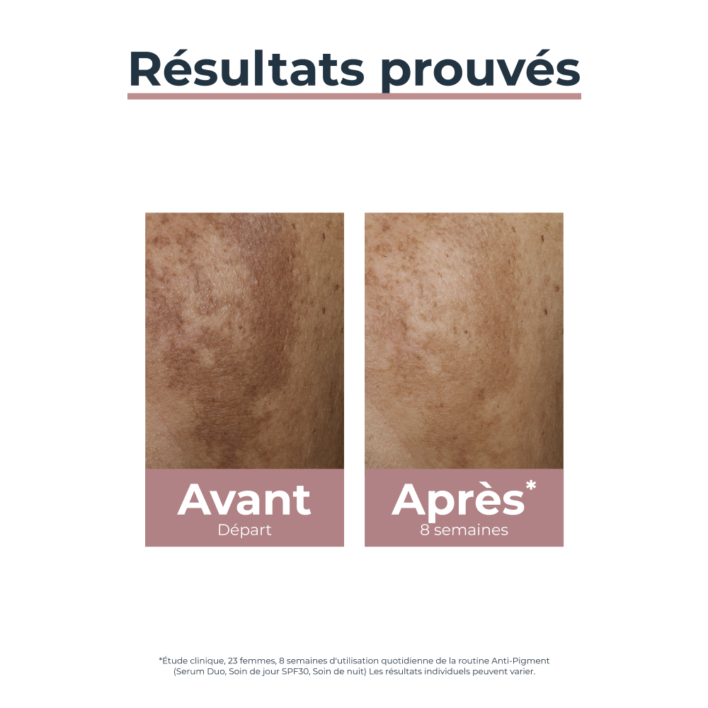 Eucerin Anti-Pigment Soin Jour Hyperpigmentation SPF30 50ml