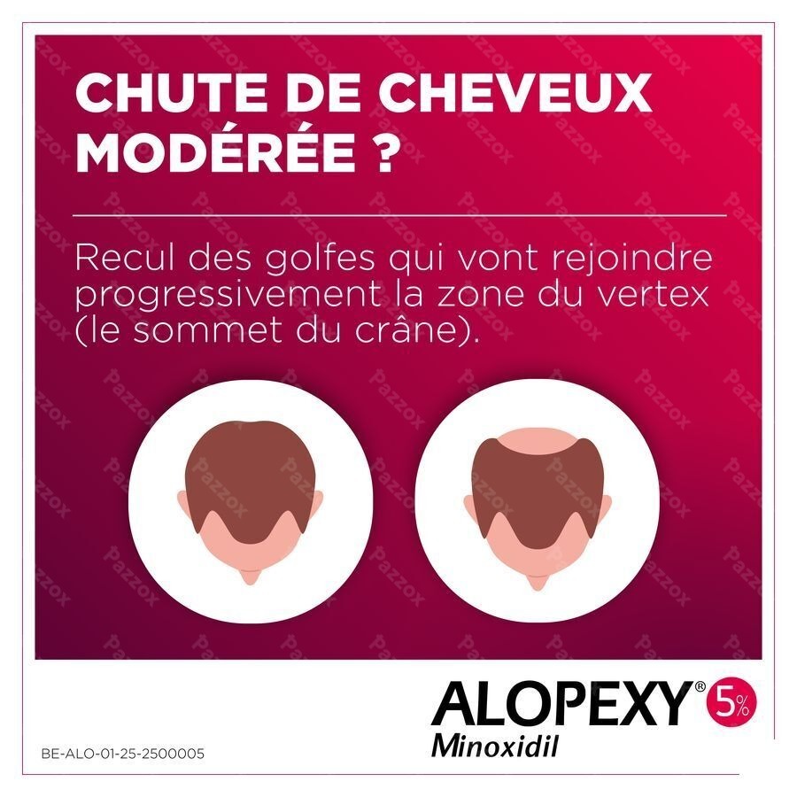 Alopexy 50mg/ml Sol Appl Cut.fl Pipette/spray 60ml