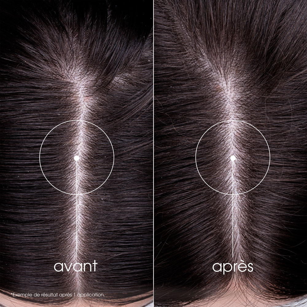 Klorane Capil. Sh Ortie 400ml Nf