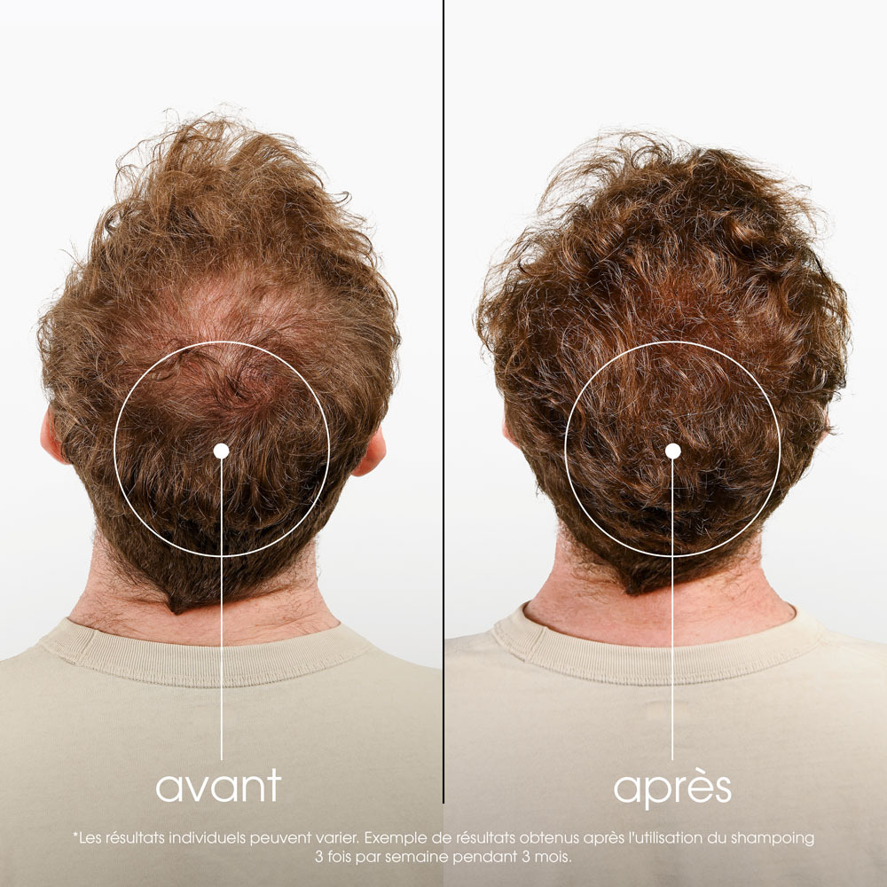 Klorane Capil. Sh Quinine 100ml