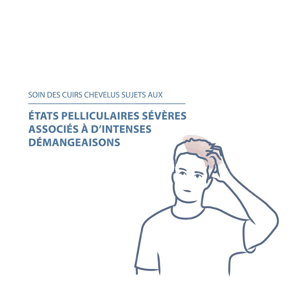 Ducray Kelual DS Shampooing États Pelliculaires Sévères 100ml