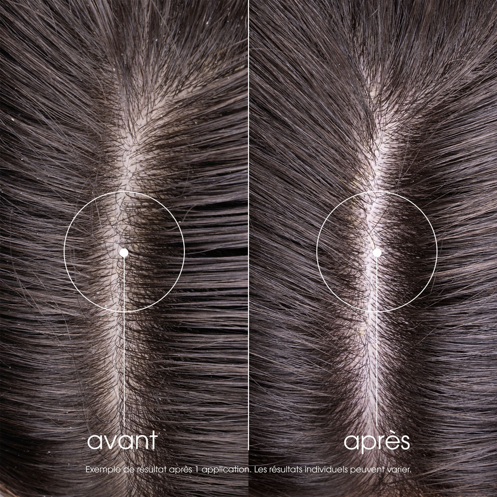 Klorane Shampooing Pulpe Cedrat 400ml Nf