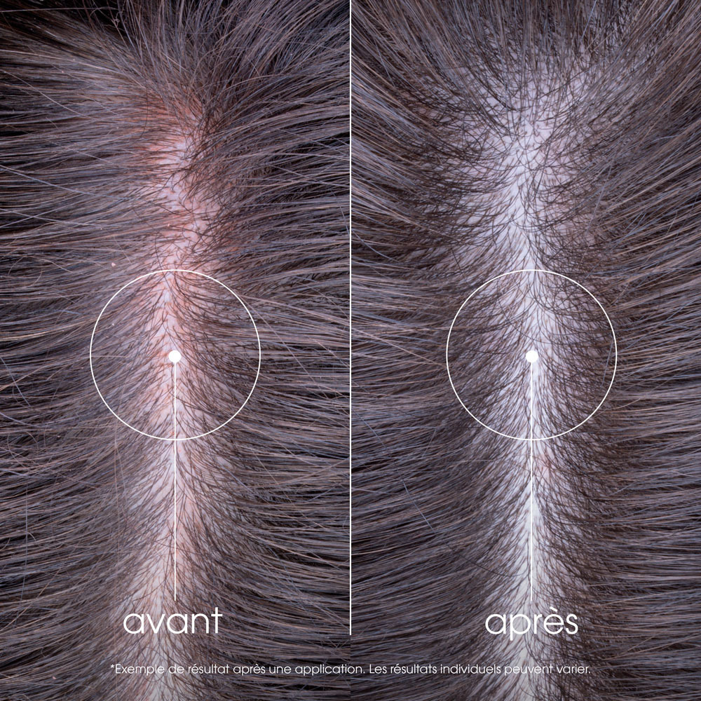 Klorane Serum Sos Pivoine Bio 100ml