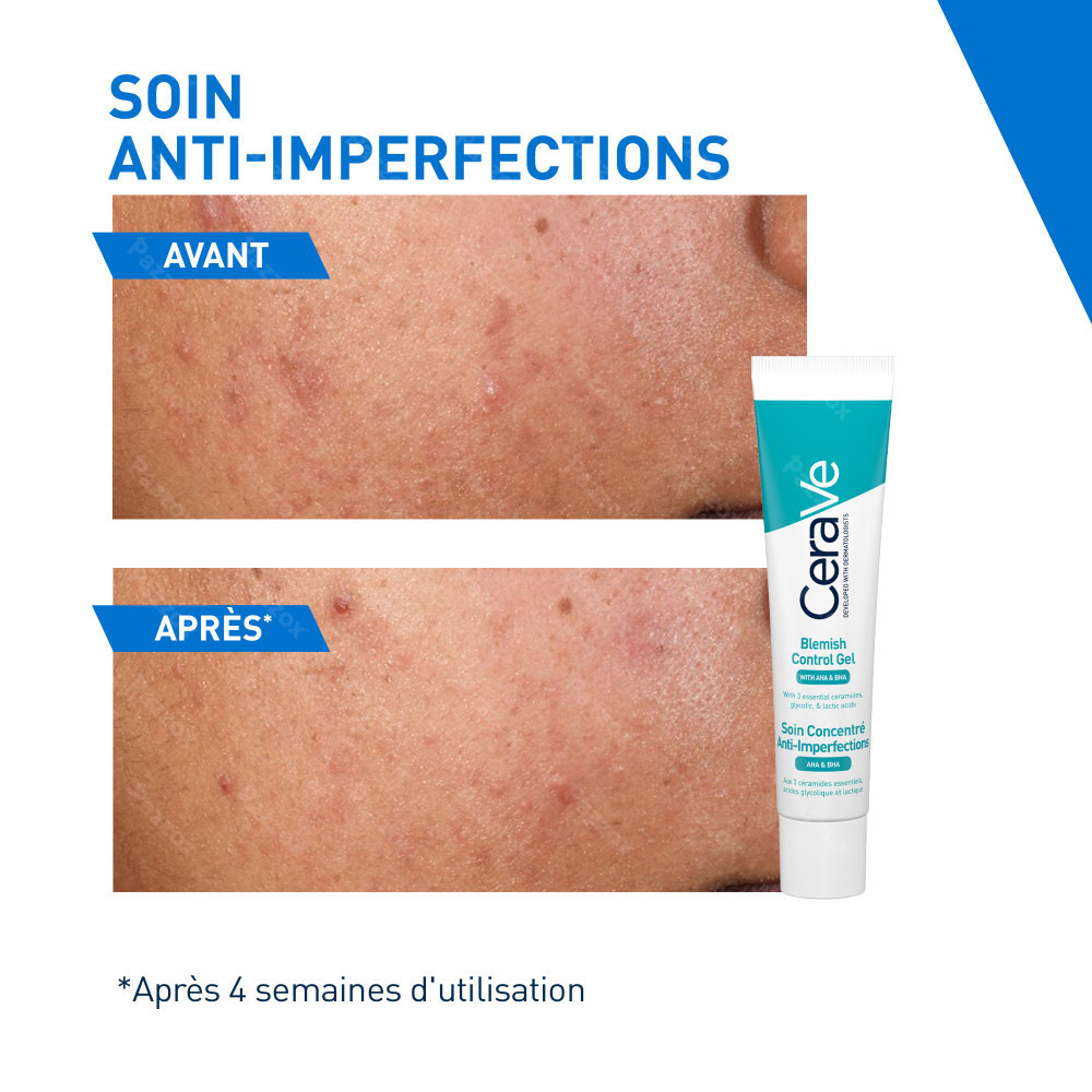 CeraVe Soin Concentré Anti-Imperfections 40ml