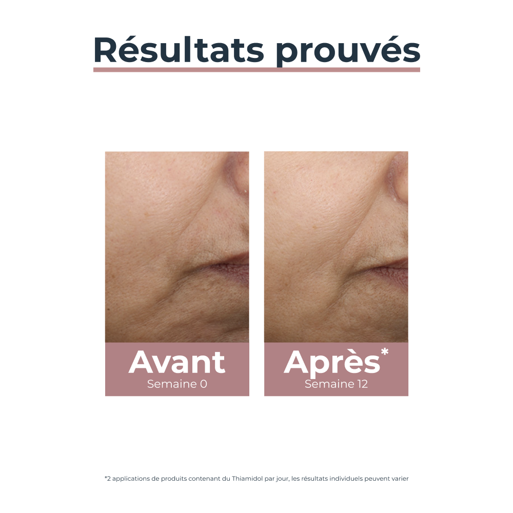 Eucerin Anti-Pigment Soin de jour Teinté SPF30 Medium Hyperpigmentation 50ml
