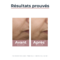 Eucerin Anti-Pigment Soin de jour Teinté SPF30 Medium Hyperpigmentation 50ml