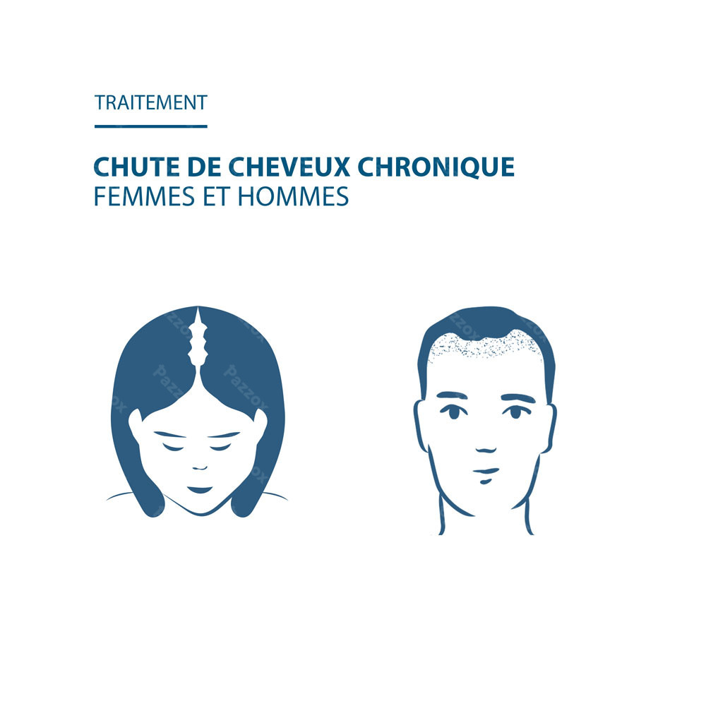 Ducray Anacaps Expert Chute De Cheveux Chronique 90 Gélules