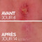 La Roche-Posay Cicaplast Baume B5+ 100ml
