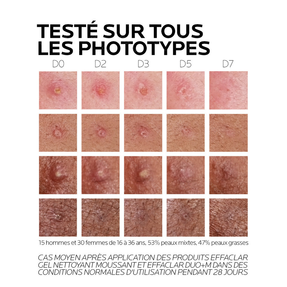 La Roche-Posay Effaclar Duo+M 40ml