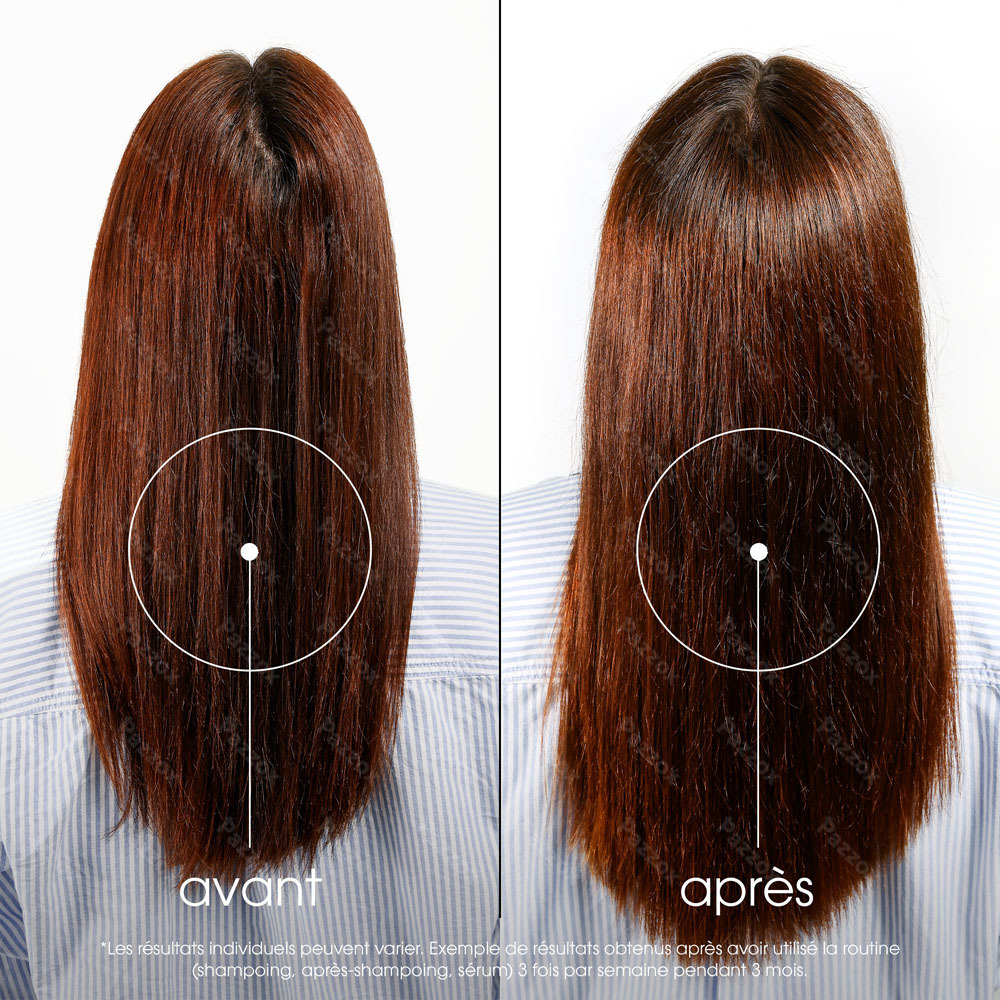Klorane Après-shampoing anti-chute à la Quinine 200ml
