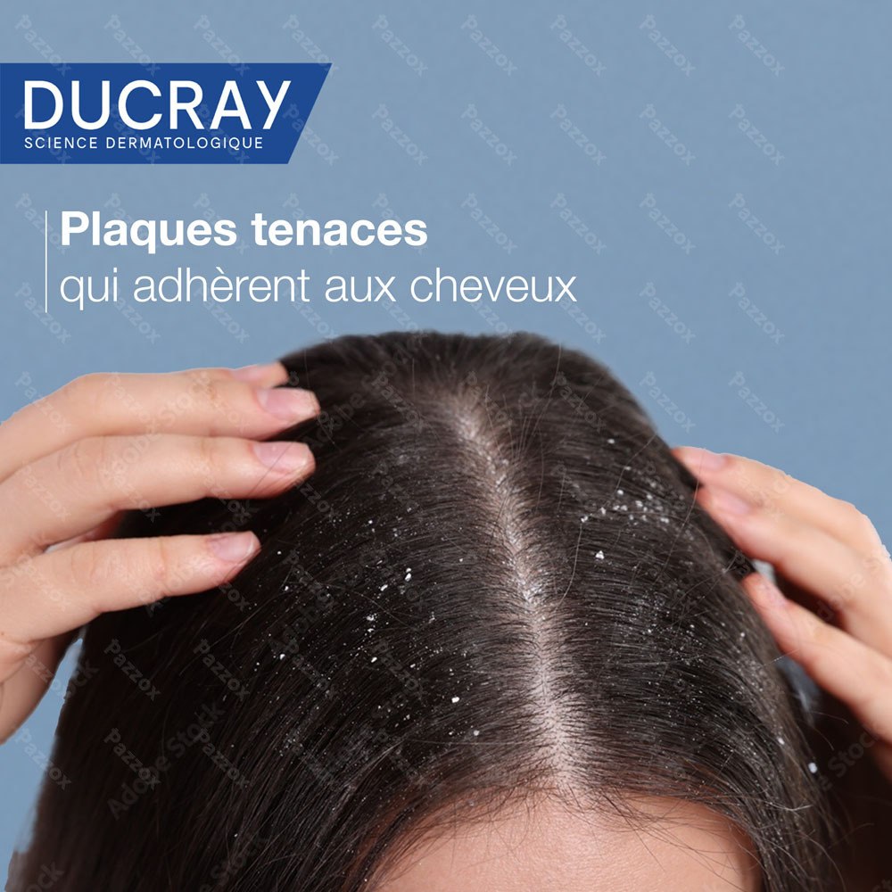 Ducray Kelual Squanorm Shampooing Pellicules 200ml