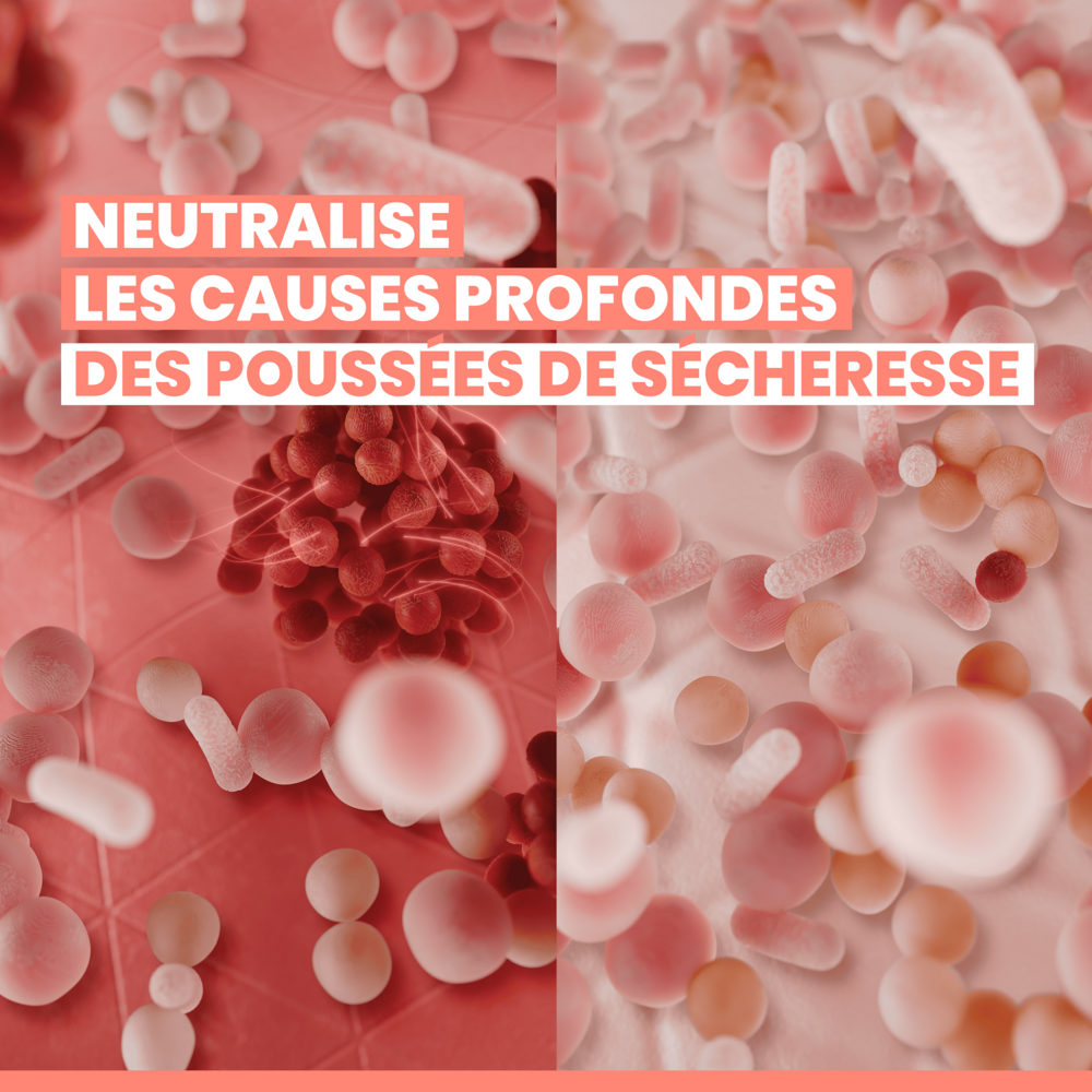 Avène XeraCalm A.D Baume relipidant, Peau très sèche sujette à l'eczéma atopique et aux démangeaisons 400ml