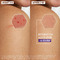 Aderma Epitheliale Ultra Repair Crème Réparatrice anti-marques 40ml