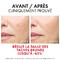 Vichy Liftactiv B3 Crème de Jour Anti-Taches SPF50 50ml