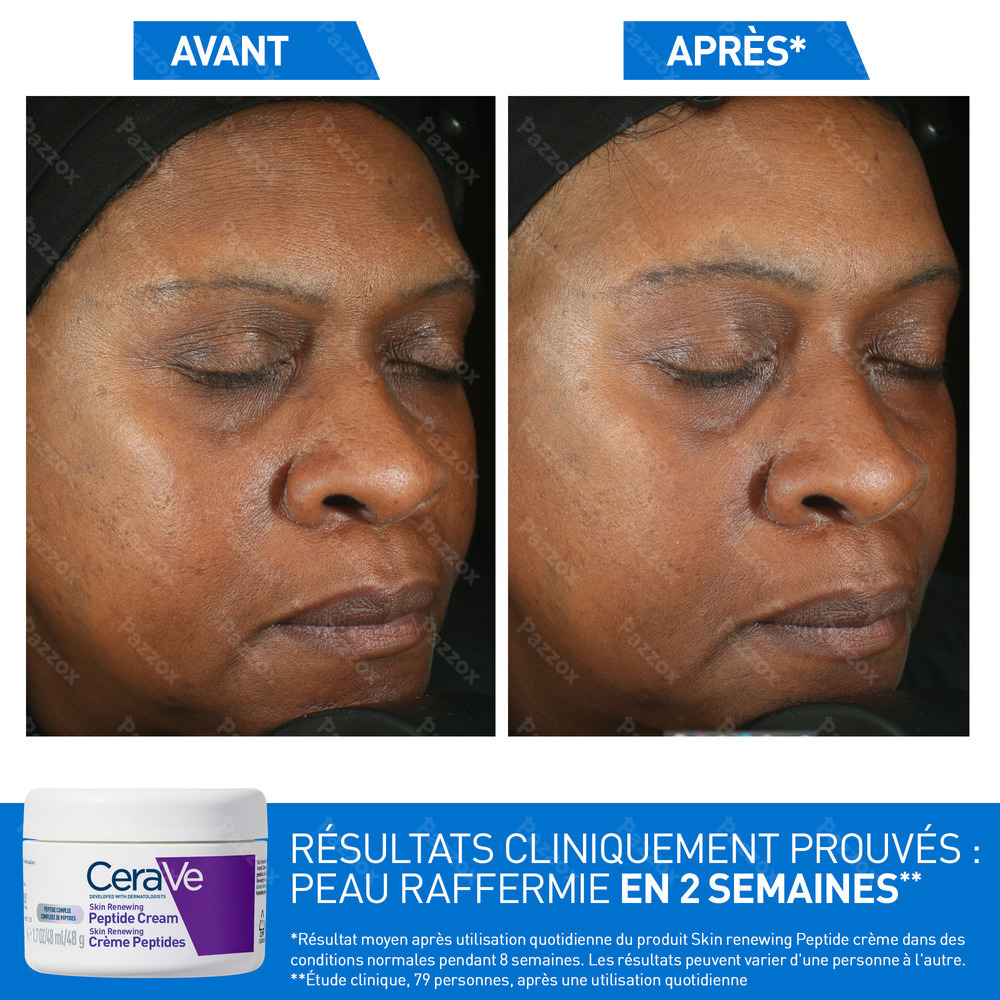 CeraVe Skin Renewing Peptide Cream 48ml