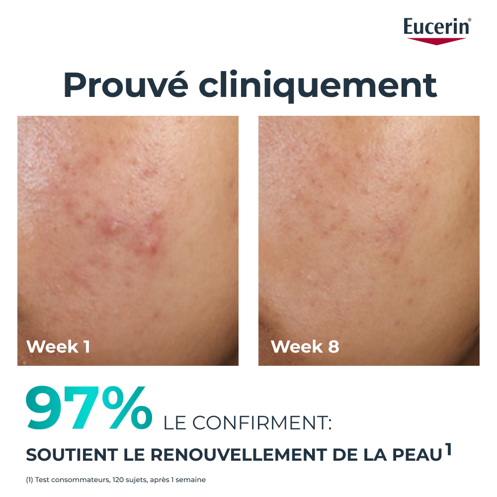Eucerin Dermopure Clinical Peeling 10 Soin Nuit 40ml