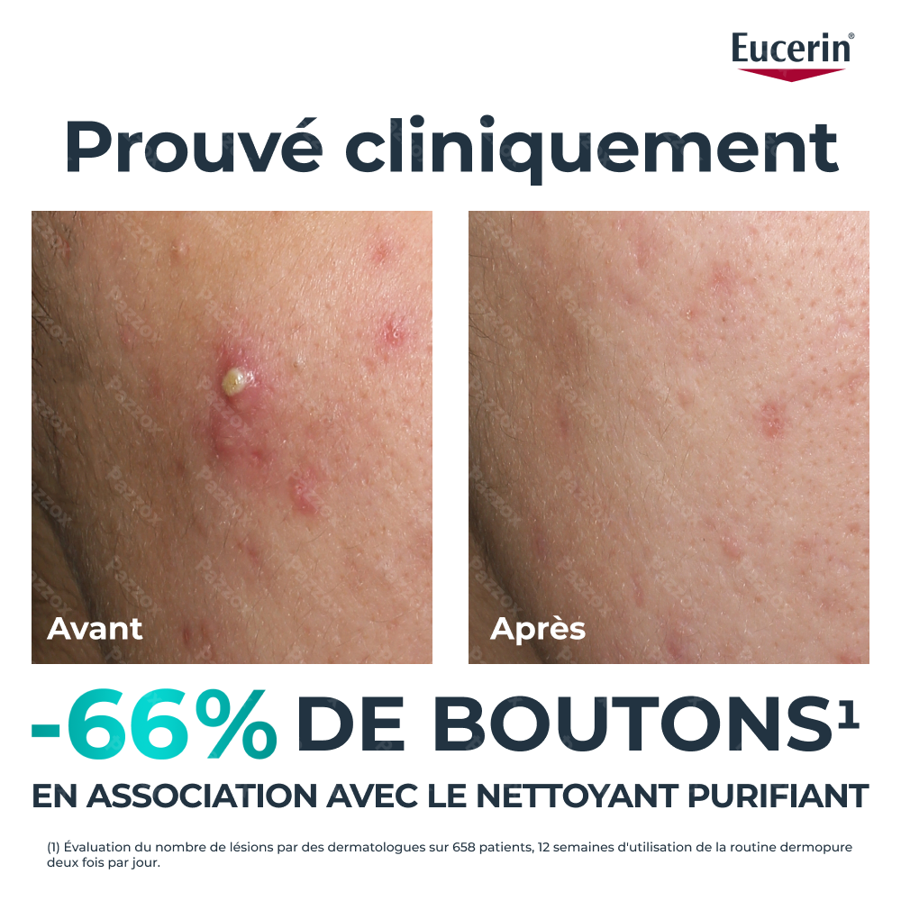 Eucerin Dermopure Clinical Fluide Triple Action 40ml