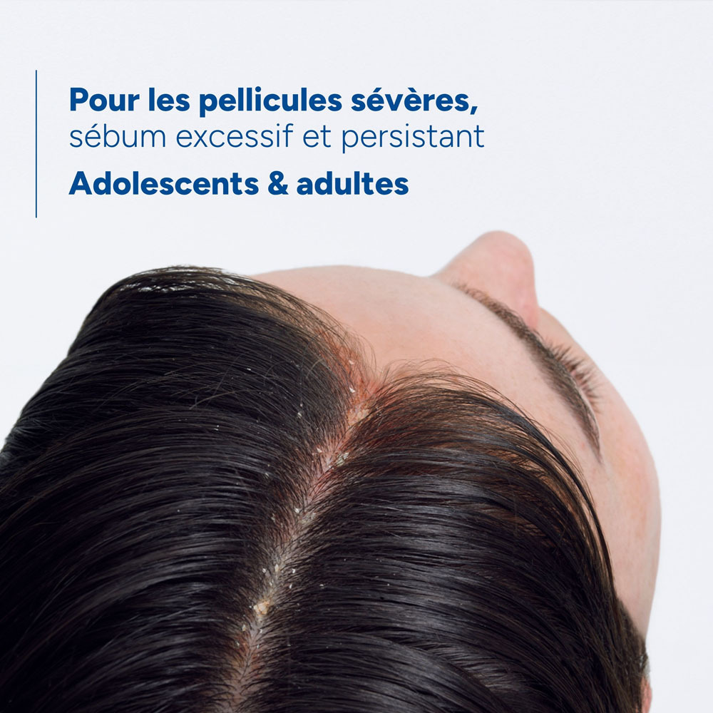 Ducray Kelual DS Sebocontrol Shampooing traitant Anti-pelliculaire, Pellicules sévères, Sébum excessif et persistant 100ml